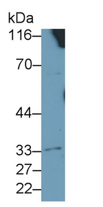 IL4R Antibody in Western Blot (WB)