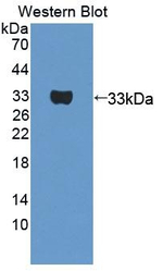 PTGFRN Antibody in Western Blot (WB)