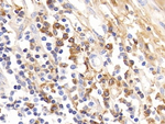 Human IgG4 Antibody in Immunohistochemistry (Paraffin) (IHC (P))