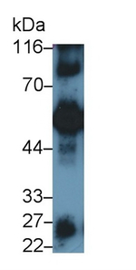 Human IgG4 Antibody in Western Blot (WB)