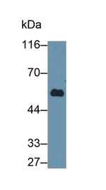 Human IgG4 Antibody in Western Blot (WB)