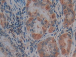 Thrombospondin 1 Antibody in Immunohistochemistry (Paraffin) (IHC (P))