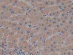 Thrombospondin 1 Antibody in Immunohistochemistry (Paraffin) (IHC (P))