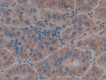 Thrombospondin 1 Antibody in Immunohistochemistry (Paraffin) (IHC (P))