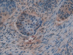 Thrombospondin 1 Polyclonal Antibody