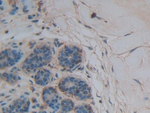 Thrombospondin 1 Antibody in Immunohistochemistry (Paraffin) (IHC (P))