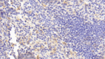 FCN1 Antibody in Immunohistochemistry (Paraffin) (IHC (P))