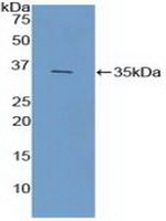 FCN1 Antibody in Western Blot (WB)