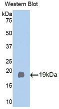 KLB Antibody in Western Blot (WB)
