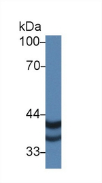 PSG2 Polyclonal Antibody