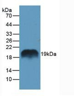 REG1A Antibody in Western Blot (WB)
