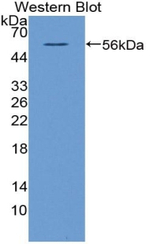 CD73 Antibody in Western Blot (WB)