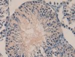 Oncomodulin Antibody in Immunohistochemistry (Paraffin) (IHC (P))