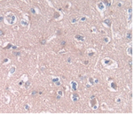 CLEC4C Polyclonal Antibody