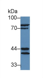 Prostate Specific Acid Phosphatase Antibody in Western Blot (WB)