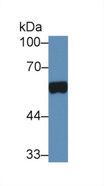 Prostate Specific Acid Phosphatase Antibody in Western Blot (WB)