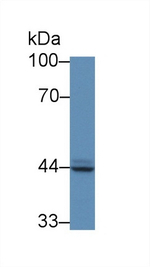 Prostate Specific Acid Phosphatase Antibody in Western Blot (WB)