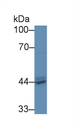 Prostate Specific Acid Phosphatase Antibody in Western Blot (WB)