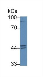 Prostate Specific Acid Phosphatase Antibody in Western Blot (WB)