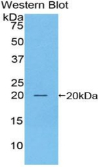 Prostate Specific Acid Phosphatase Antibody in Western Blot (WB)