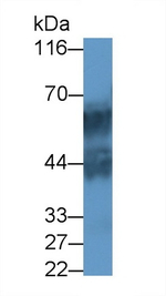 KRT71 Polyclonal Antibody