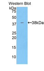 KRT71 Antibody in Western Blot (WB)