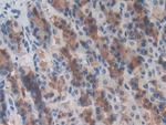 GARP Antibody in Immunohistochemistry (Paraffin) (IHC (P))