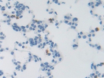 GARP Antibody in Immunohistochemistry (Paraffin) (IHC (P))