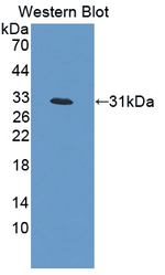GARP Antibody in Western Blot (WB)