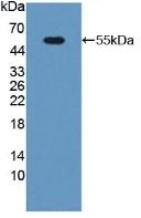PGP Antibody in Western Blot (WB)