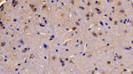 EpoR Antibody in Immunohistochemistry (Paraffin) (IHC (P))