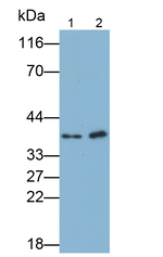 WT1 Polyclonal Antibody