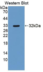 OASL Polyclonal Antibody