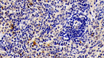 MMP9 Antibody in Immunohistochemistry (Paraffin) (IHC (P))