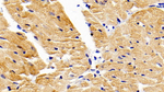 MMP9 Polyclonal Antibody