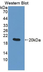 MMP9 Antibody in Western Blot (WB)