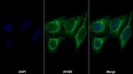 TACR2 Antibody in Immunocytochemistry (ICC/IF)