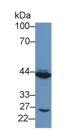 TACR2 Antibody in Western Blot (WB)