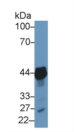 TACR2 Antibody in Western Blot (WB)