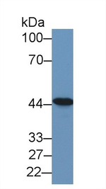 TACR2 Antibody in Western Blot (WB)