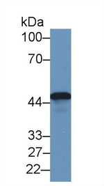TACR2 Antibody in Western Blot (WB)