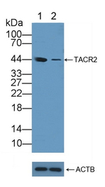 TACR2 Antibody in Western Blot (WB)