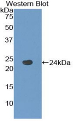 TACR2 Antibody in Western Blot (WB)