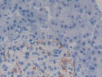 CD138 Antibody in Immunohistochemistry (Paraffin) (IHC (P))