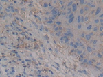 CD138 Antibody in Immunohistochemistry (Paraffin) (IHC (P))