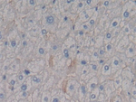 CD138 Antibody in Immunohistochemistry (Paraffin) (IHC (P))