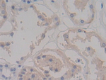 CD138 Antibody in Immunohistochemistry (Paraffin) (IHC (P))