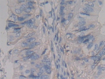 CD138 Antibody in Immunohistochemistry (Paraffin) (IHC (P))