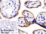 CD138 Antibody in Immunohistochemistry (Paraffin) (IHC (P))