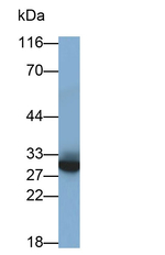 CD138 Antibody in Western Blot (WB)